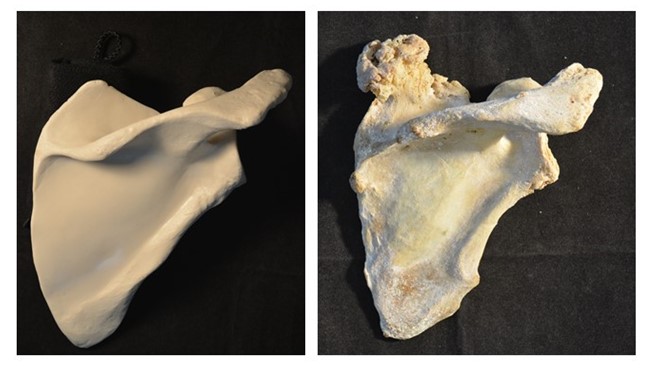 photograph of a bone with a large tumor